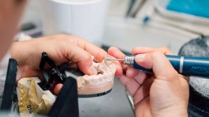 Dental Lab Marketing